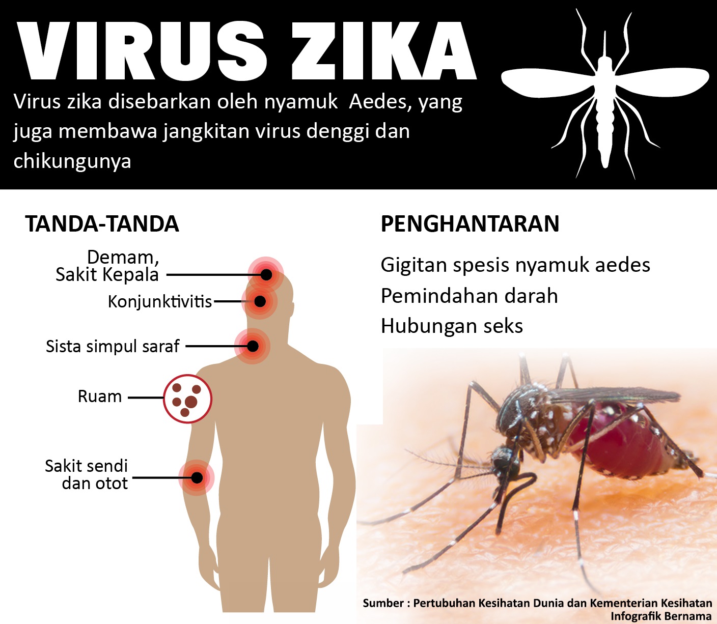 5 Perkara yang perlu anda tahu mengenai Virus Zika 